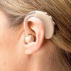 New Device to Ease Symptoms of Tinnitus
